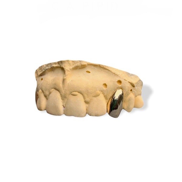 Single 18K Gold Cap
