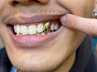 Single 14K Gold Cap