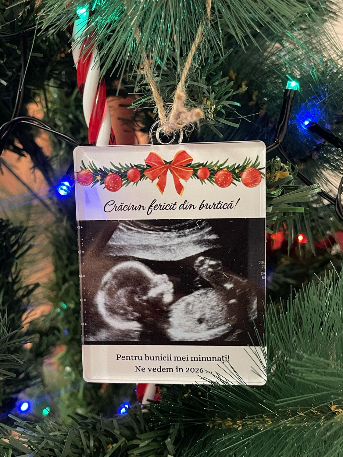 Ornament de Crăciun Personalizat – Din burtica mamei  🎄