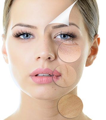 ANTI-AGING