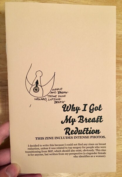 My Breast Reduction - Zine by Heather Jackson