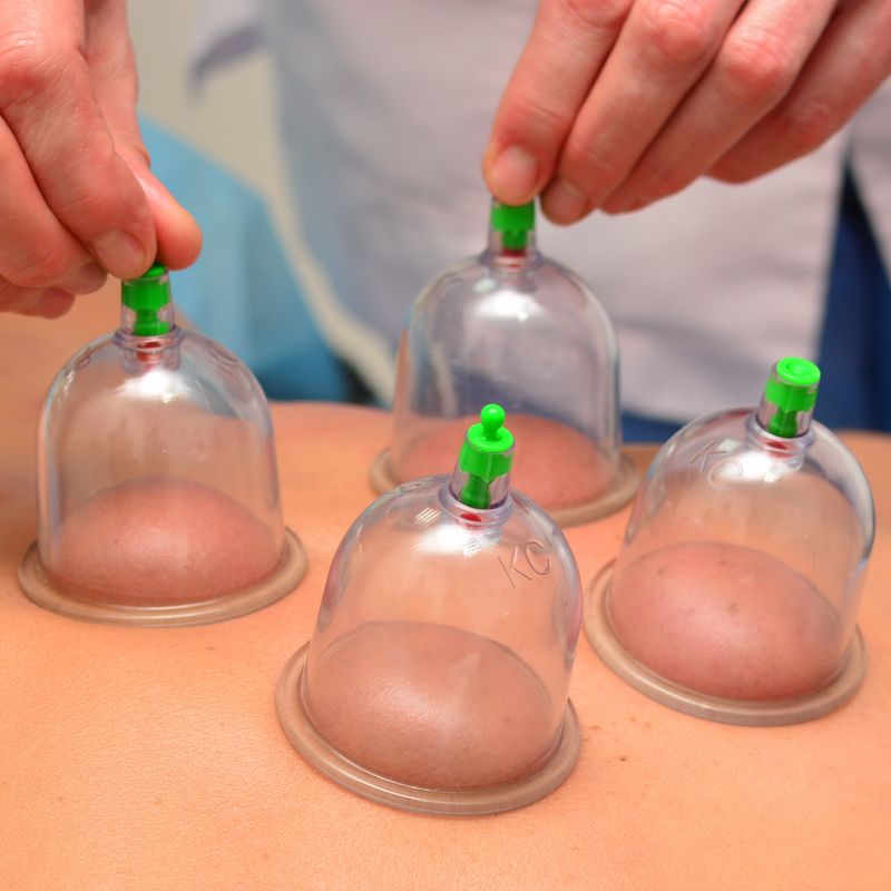 60 Minute Dry Cupping Massage (Home Appointment)