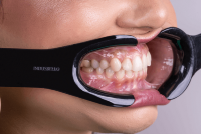Photography Retractors