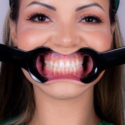 Cheek Retractors