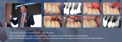 Titanium Peri-implantitis Brush
