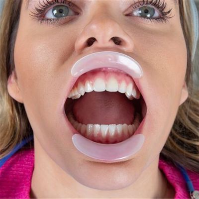 Lip Ring Retractor