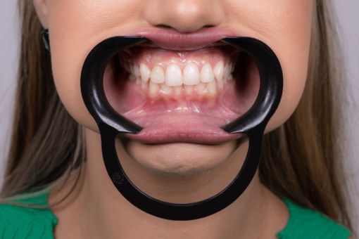 Spandex Lip Retractor