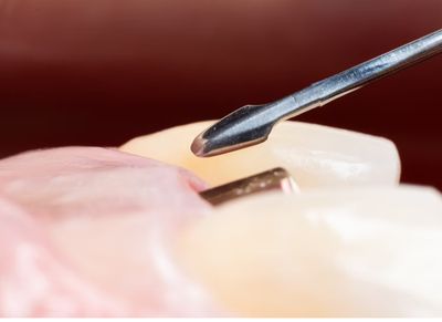 Periodontal Instruments