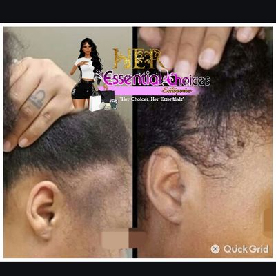 Hair Growth Oil