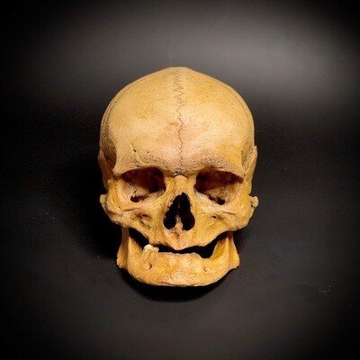 Мужской череп человека «Дед» (анатомическая модель)