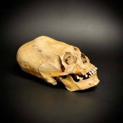 Череп человека «Перуанский» (анатомическая модель)