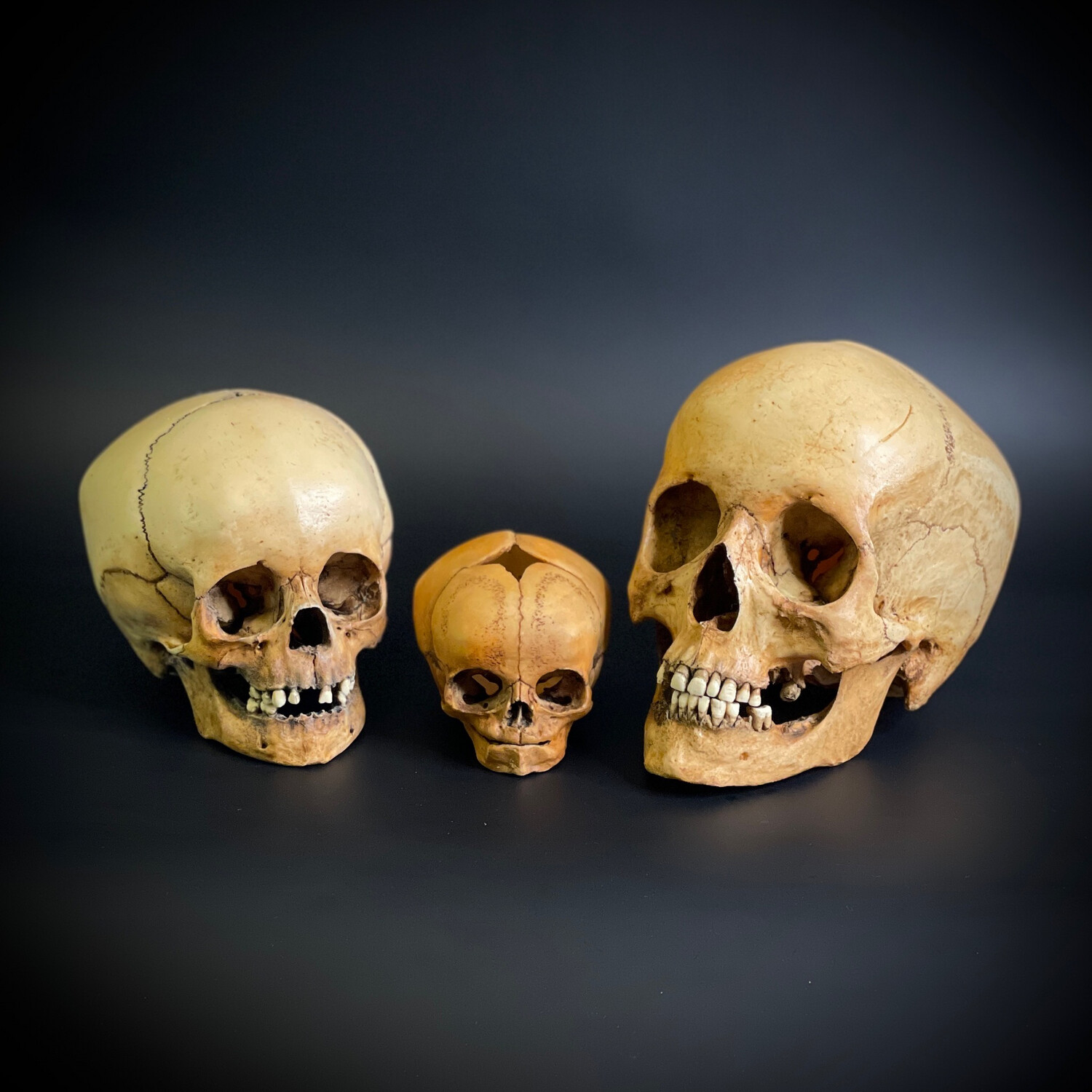 Женский череп человека + череп ребенка + череп младенца (анатомические модели)