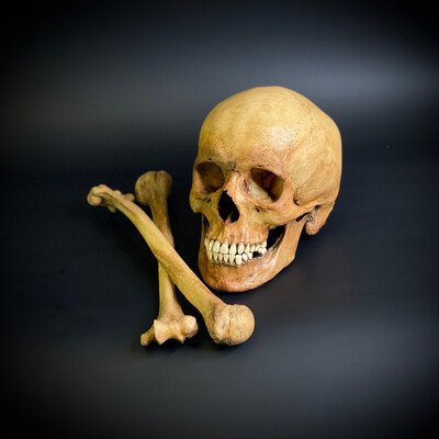 Череп человека с костями (анатомические модели)