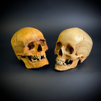 Женский череп человека азиатский + мужской череп человека европейский (анатомические модели)