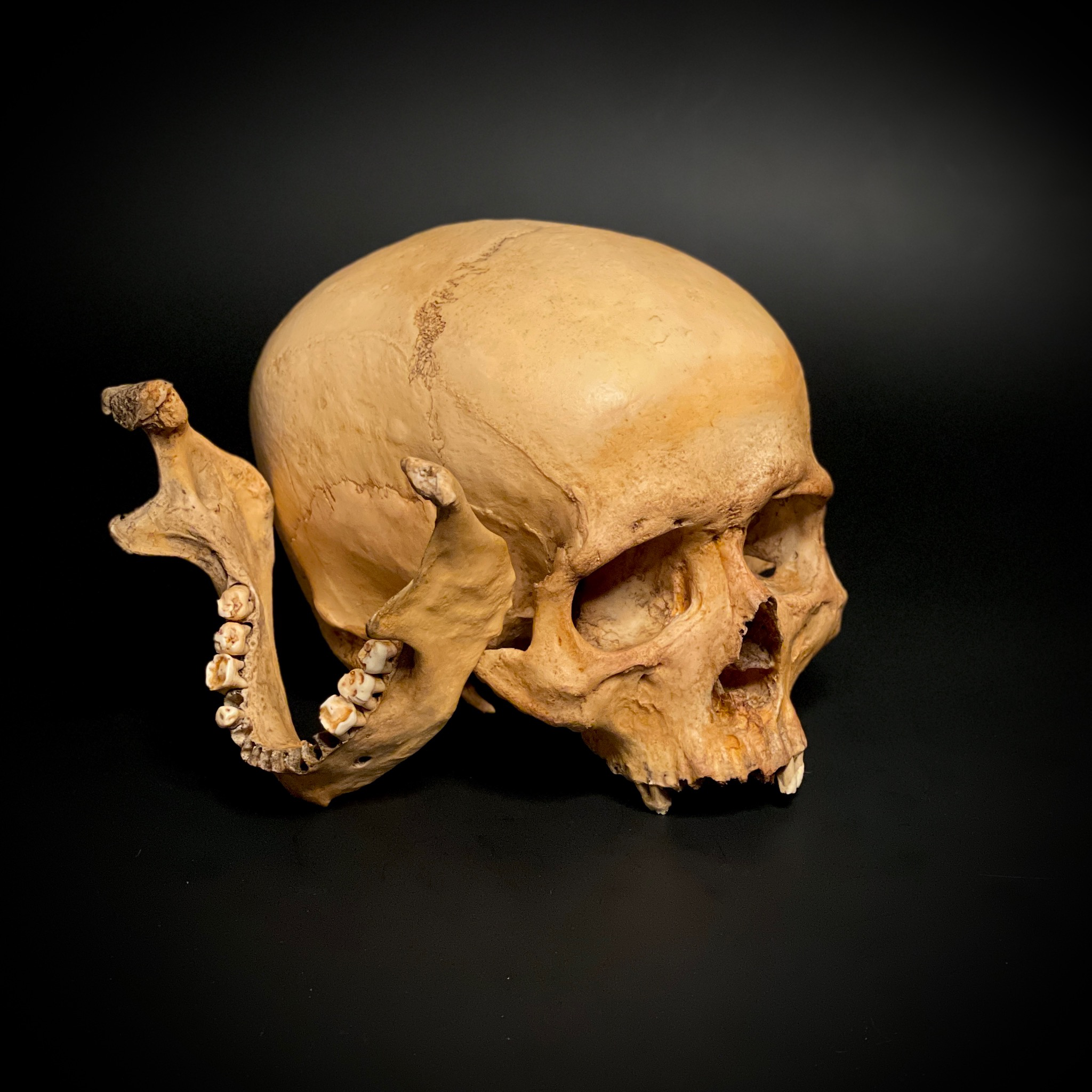 Адамов череп. Череп 2023. Circa skull. Фото черепов маленьких детей. Трафарет череп для плазмы.