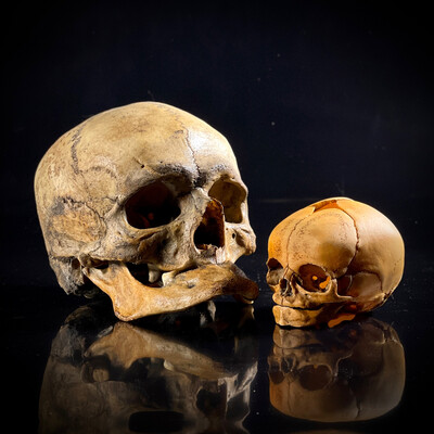 Мужской череп человека + череп младенца (анатомические модели)