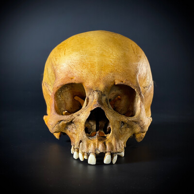 Мужской череп человека без нижней челюсти (анатомическая модель)
