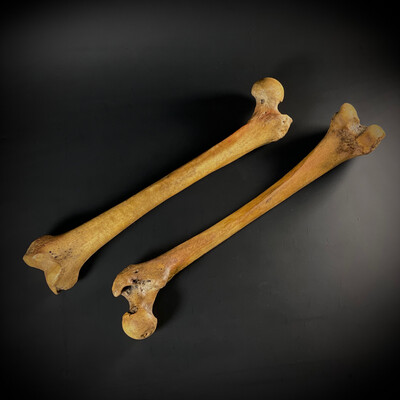 Бедренные кости человека (анатомические модели)