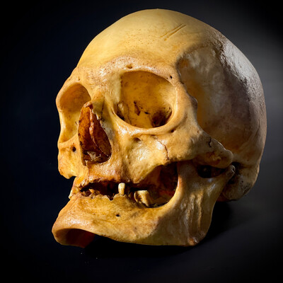 Женский череп человека «Старуха» (анатомическая модель)