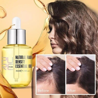 PURC Ginger Essence Hair Growth ™