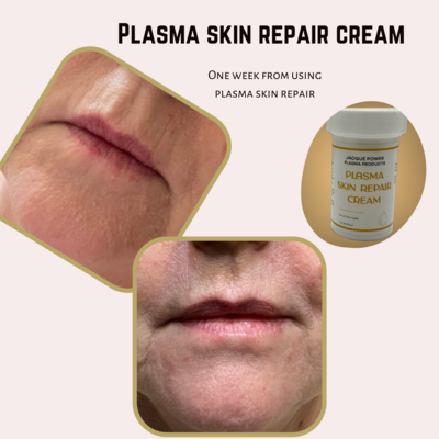 Plasma Skin Repair Cream