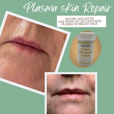 Plasma Skin Repair Cream