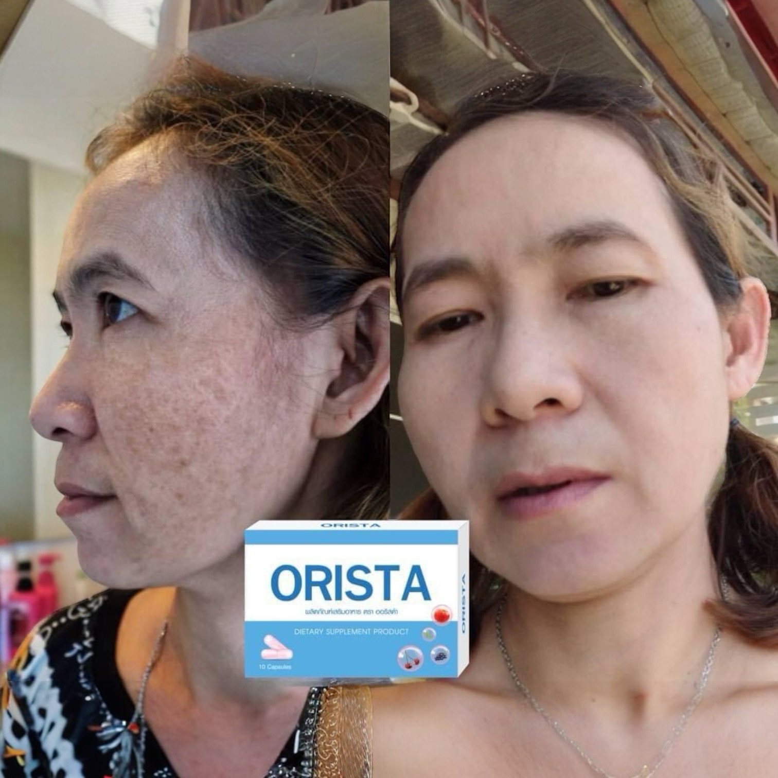 Orista Plus Dietary Supplement (10 Capsules)