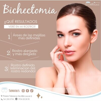 Bichectomia