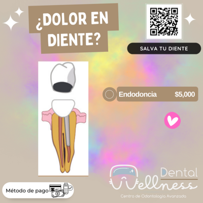 ENDODONCIA EN DIENTE