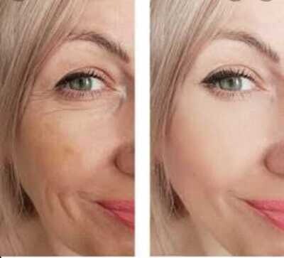 Anti Wrinkle Creams