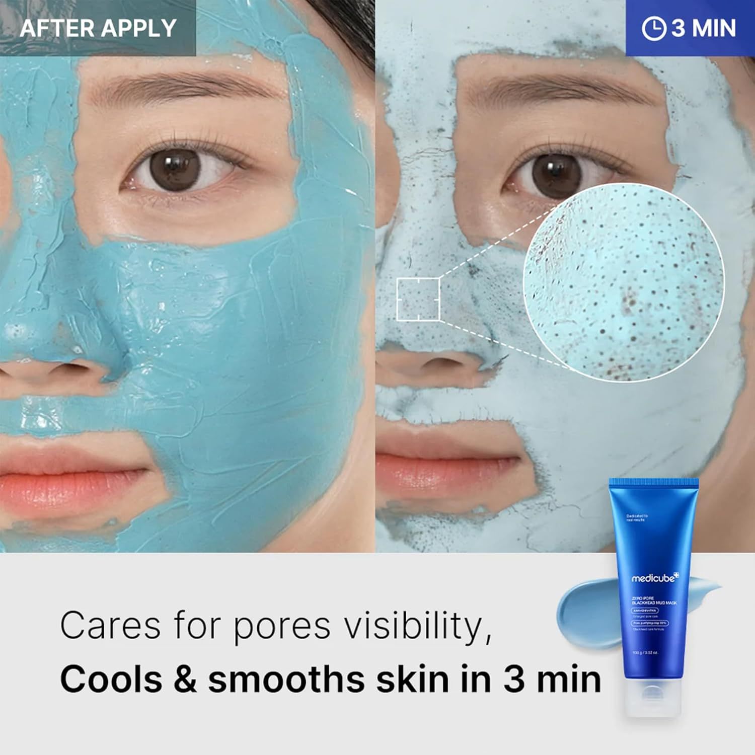 MEDICUBE ZERO PORE BLACKHEAD MUD MASK