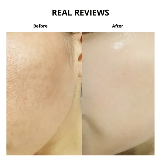 NUMBUZIN No.5 Vitamin-Niacinamide Concentrated Pad
