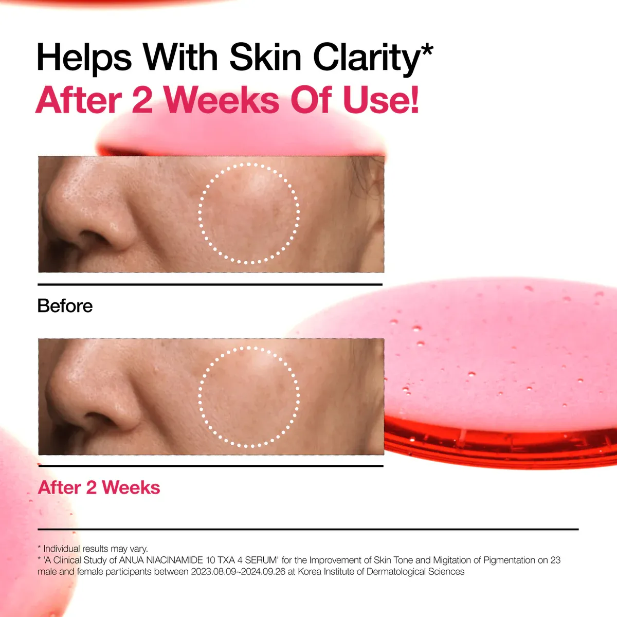 ANUA Niacinamide 10% + TXA 4% Serum (30ml)