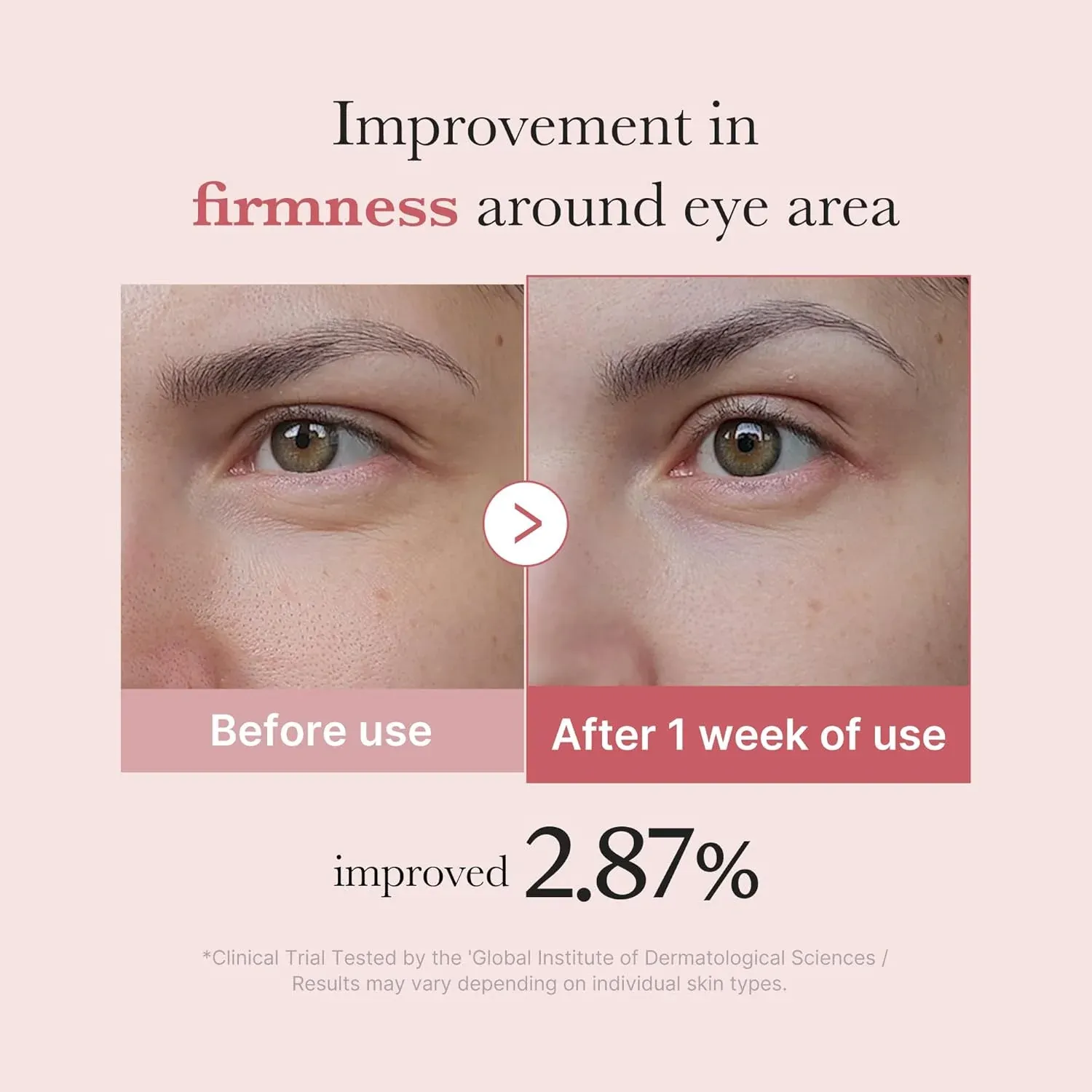 MEDICUBE PDRN Pink Peptide Eye Serum 30ml
