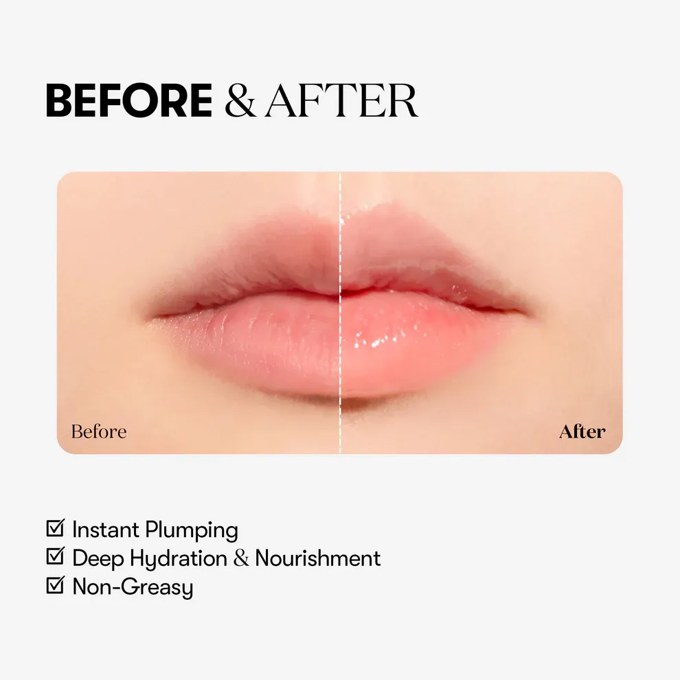 VT COSMETICS Reedle shot Lip Plumper_Beginner