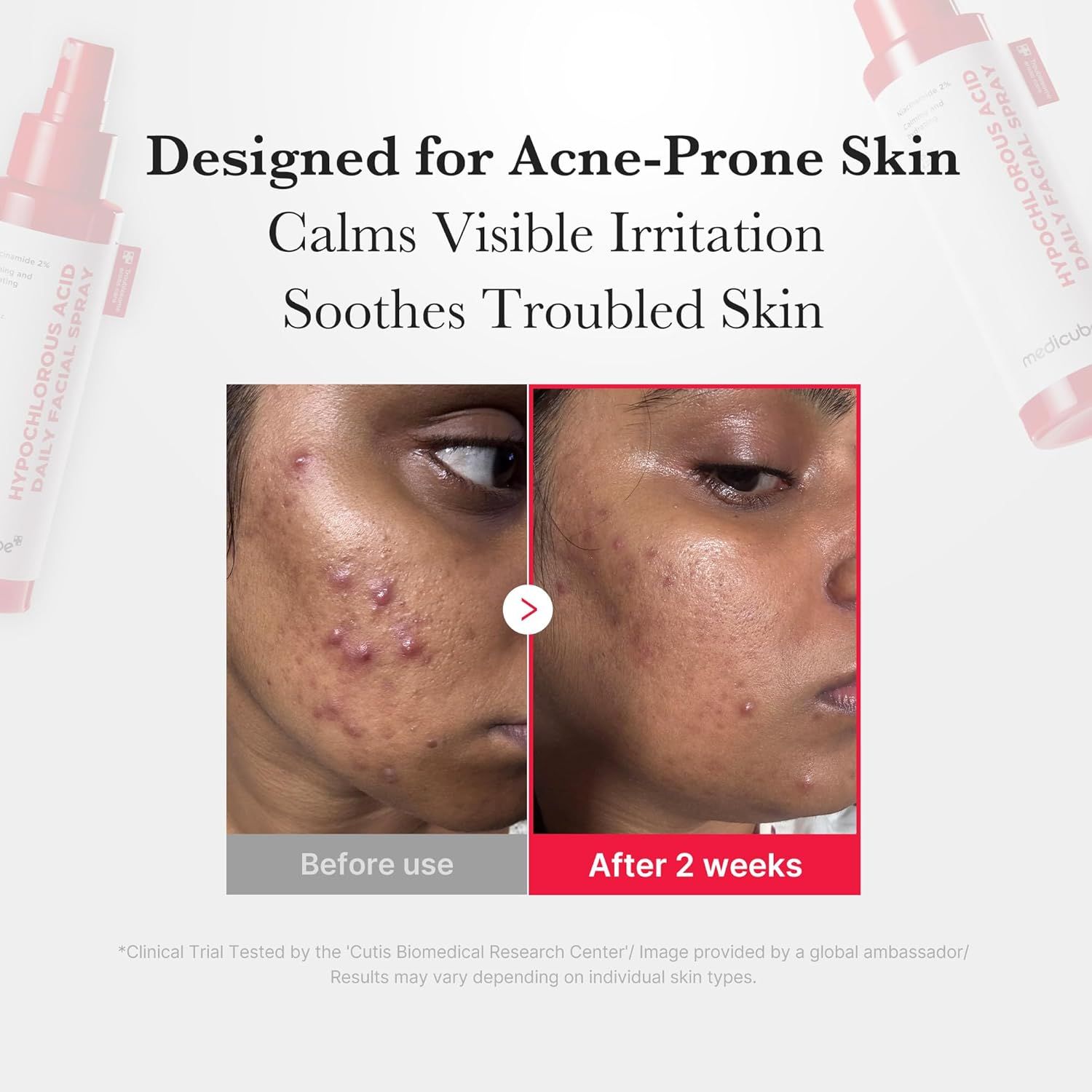 MEDICUBE Hypochlorous Acid Daily Facial Spray 125ml