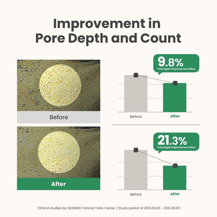 AXIS-Y Mugwort Pore Clarifying Wash Off Pack 100ml