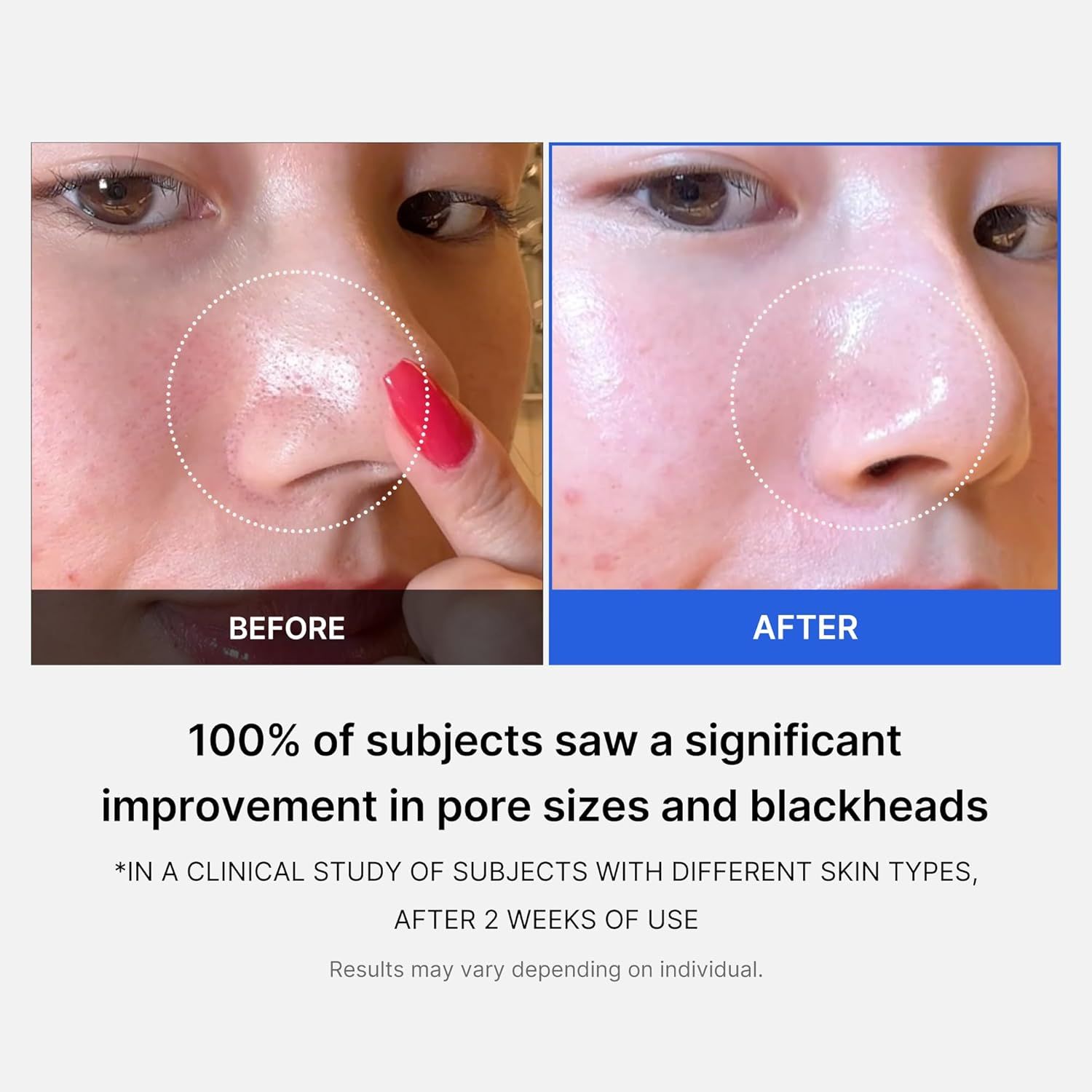 MEDICUBE Zero Pore Pad 2.0  