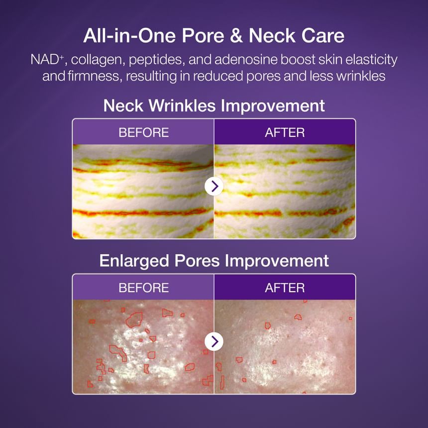 Numbuzin No. 9 NAD Bio Lifting-sil Full Face Pack Sheet (1ea)