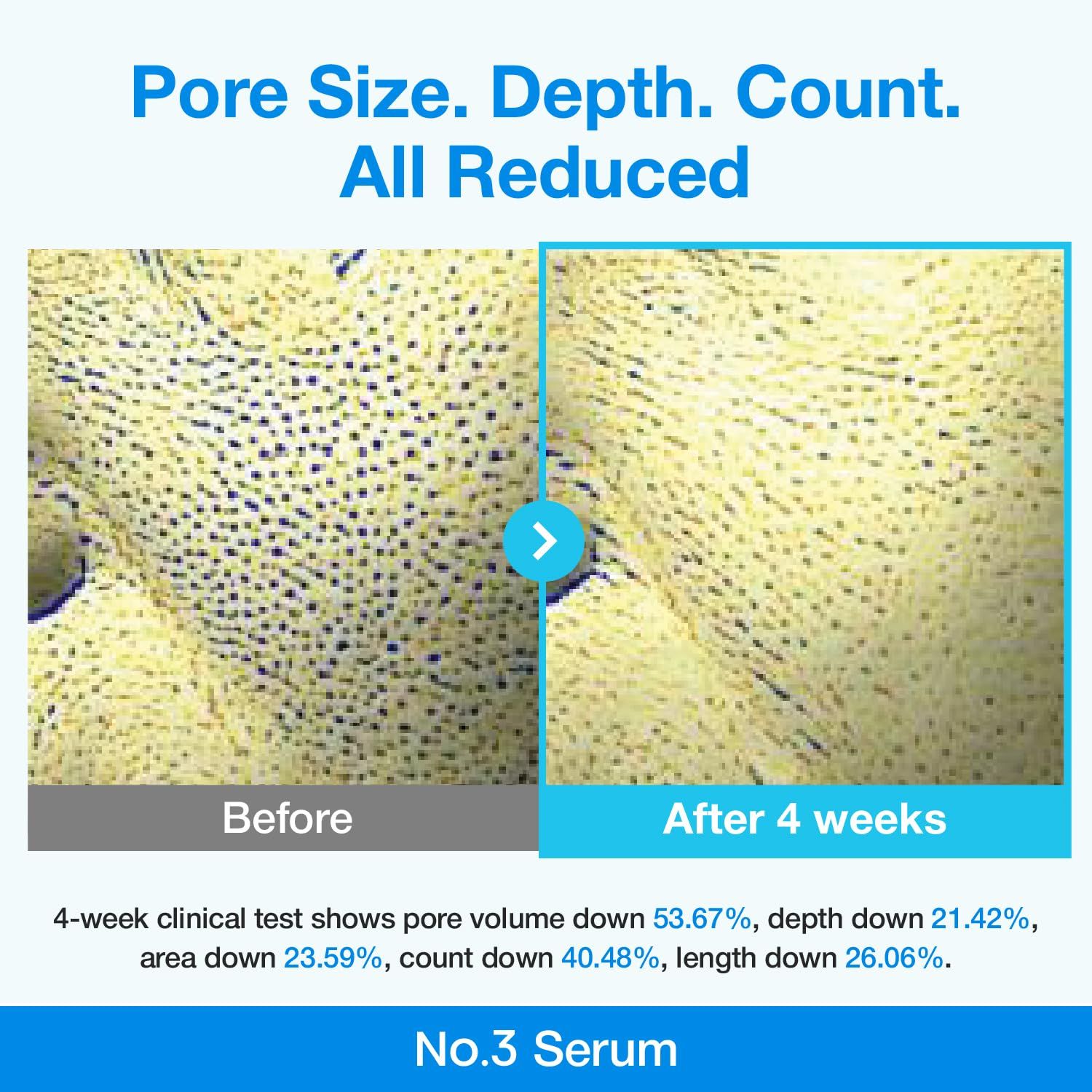 Numbuzin No.3 Blue Bio-Retinol Pore Refining Serum 30ml