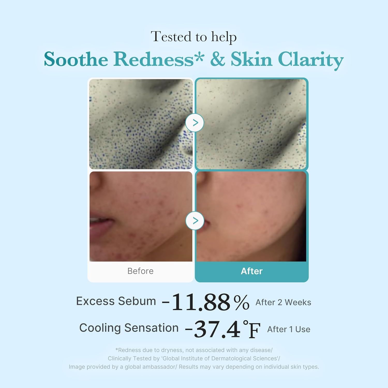 MEDICUBE Azelaic Acid Niacinamide Clear Toner 50ml