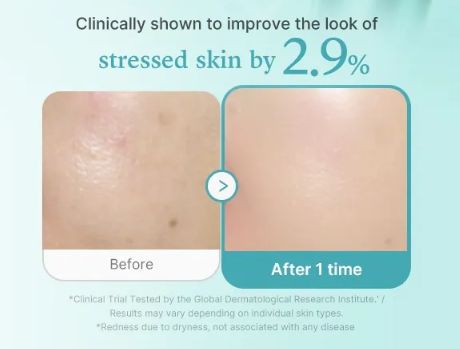 MEDICUBE Azelaic Acid Exosome Shot 7500 5ml