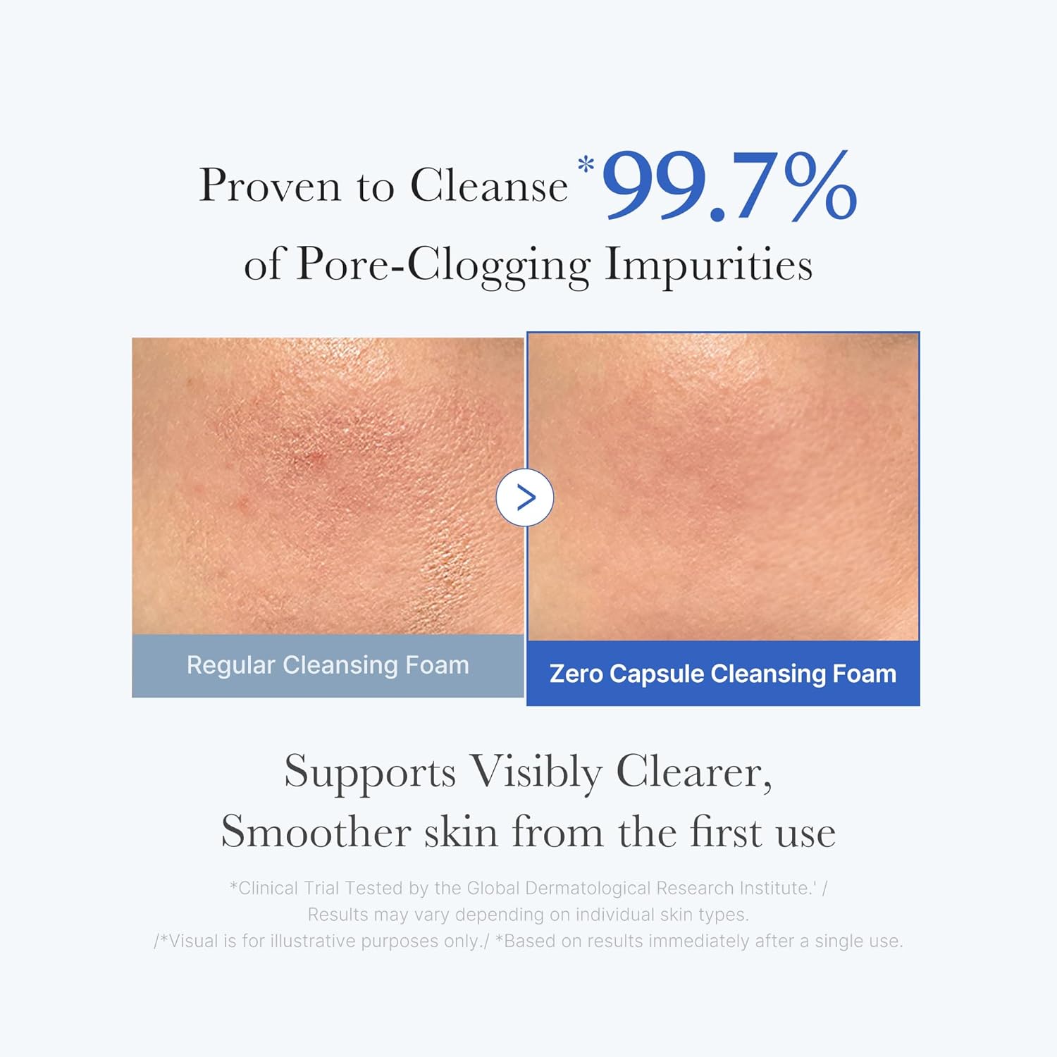 MEDICUBE Zero Pore SA Clear Capsule Cleansing Foam 120g