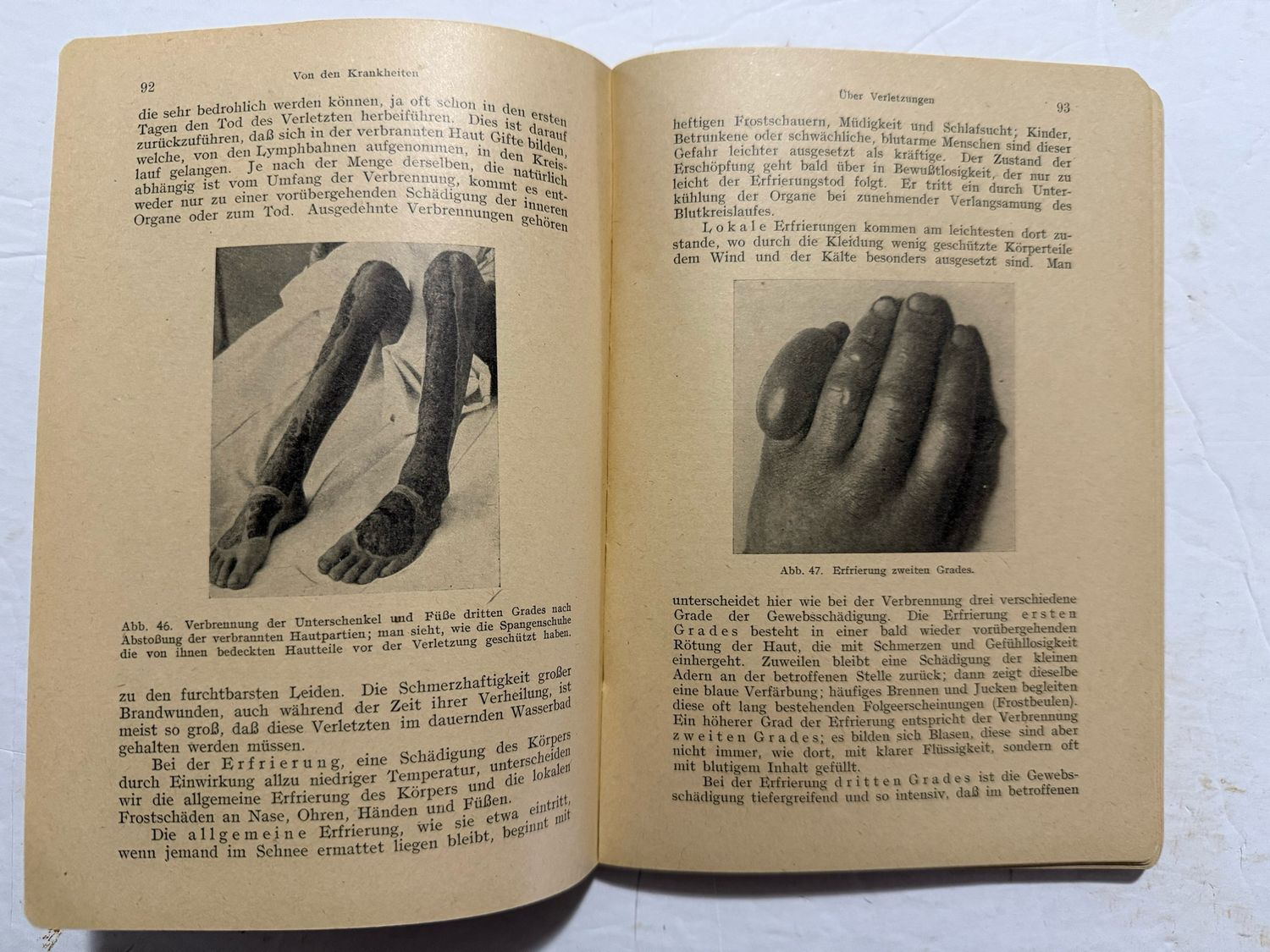 FACEBOOK AUCTION - German WW2 DRK Book, Introduction To Nursing 1942 Deutsche Red Cross Nursing Student Textbook *