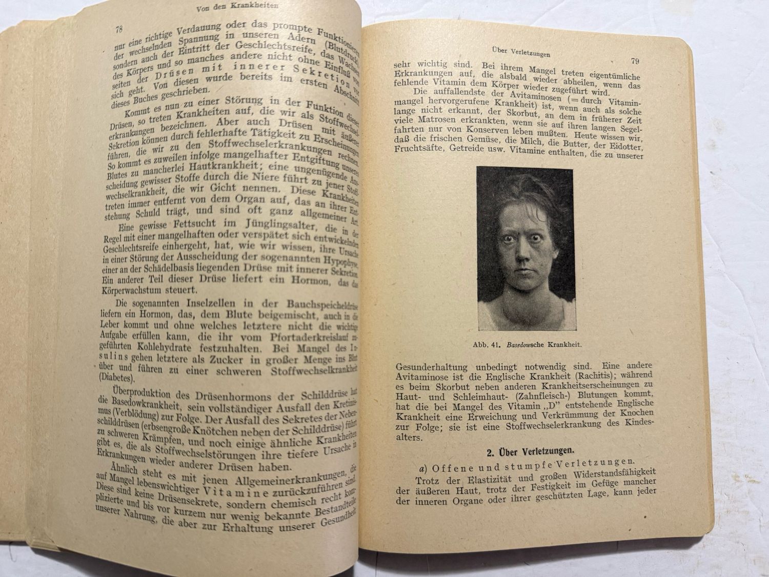 FACEBOOK AUCTION - German WW2 DRK Book, Introduction To Nursing 1942 Deutsche Red Cross Nursing Student Textbook *
