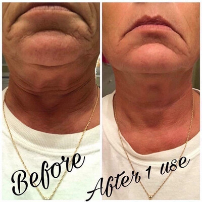 Face Lift with Activator (Original Formula)