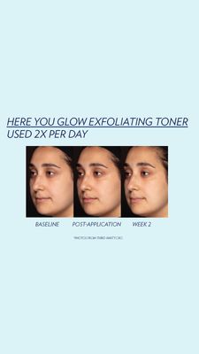 Here You Glow Exfoliating Toner
