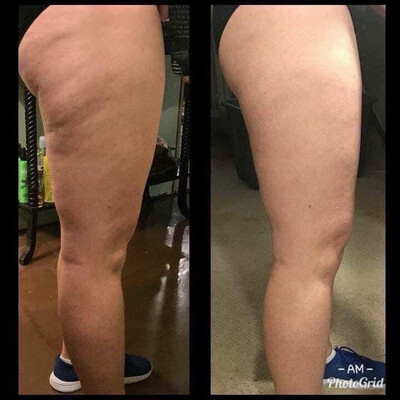 Firming Lotion/ Cellulite Cream