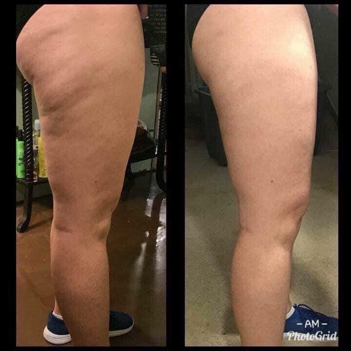 Firming Lotion/ Cellulite Cream