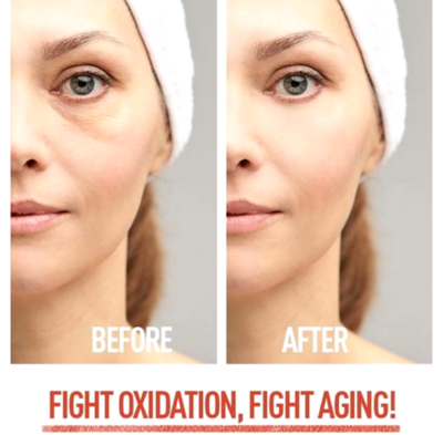 Fight Oxidation, Fight Aging